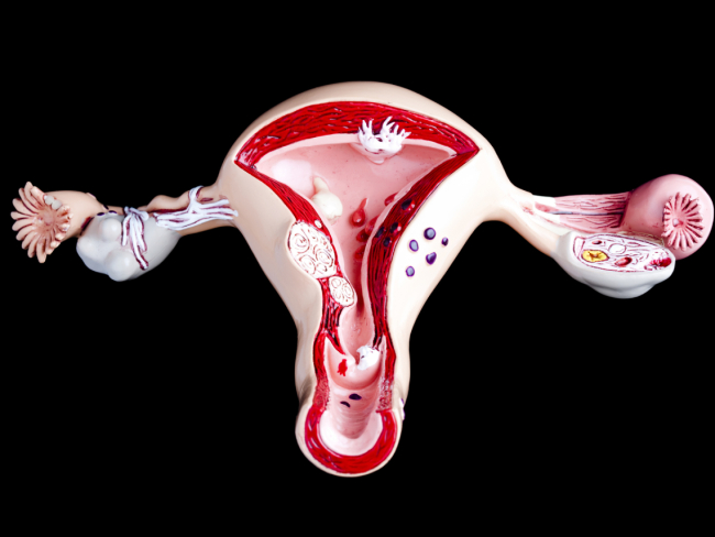 Imagen aparato reproductor femenino. Fuente: Istock.
