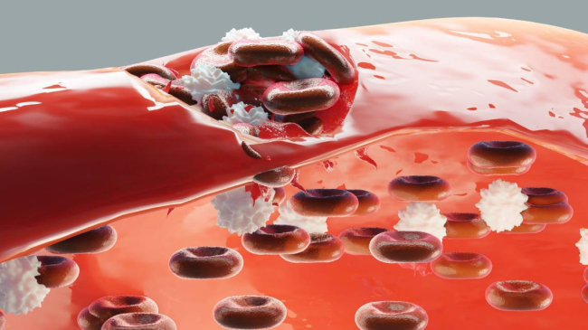 Rotura de un vaso sanguíneo y la actuación de las plaquetas