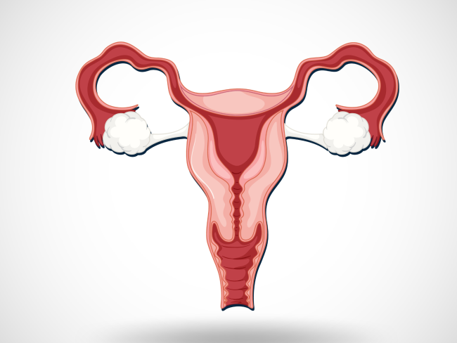 No es lo mismo tener quistes ováricos que síndrome de ovario poliquístico (SOP) (Ilustrado por: brgfx; freepik.com)