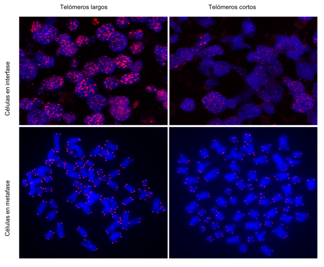 Células humanas con telómeros largos (izquierda) y con telómeros cortos (derecha). Las imágenes de los paneles superiores se corresponden con células en interfase y la de los inferiores con células en metafase. /CNIO