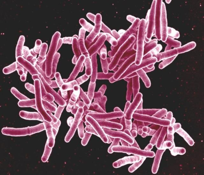 Micrografía electrónica de barrido de la bacteria Mycobacterium tuberculosis, que causa la tuberculosis /NIAID